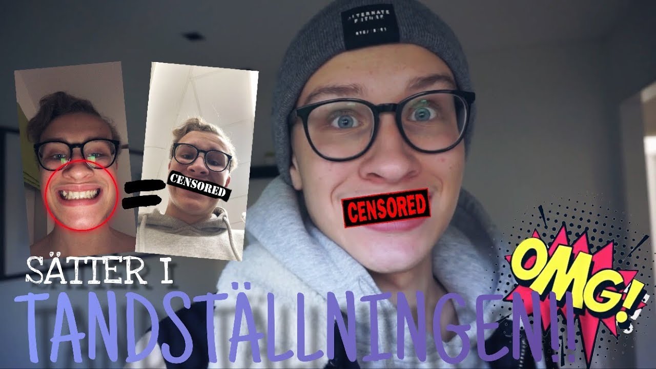FÅR MIN TANDSTÄLLNING! | VLOG² 50