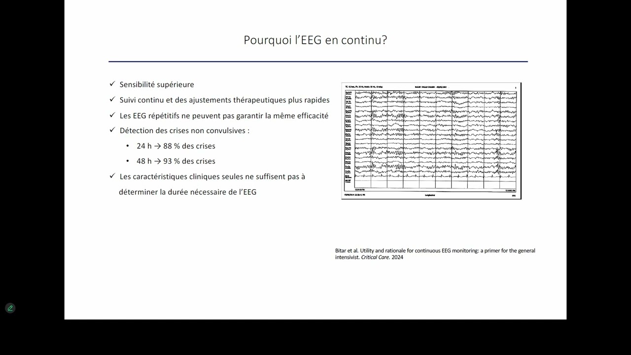 EEG en neuro réanimation
