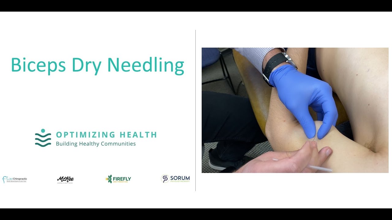 INSANE Biceps Twitch Response | Biceps Dry Needling