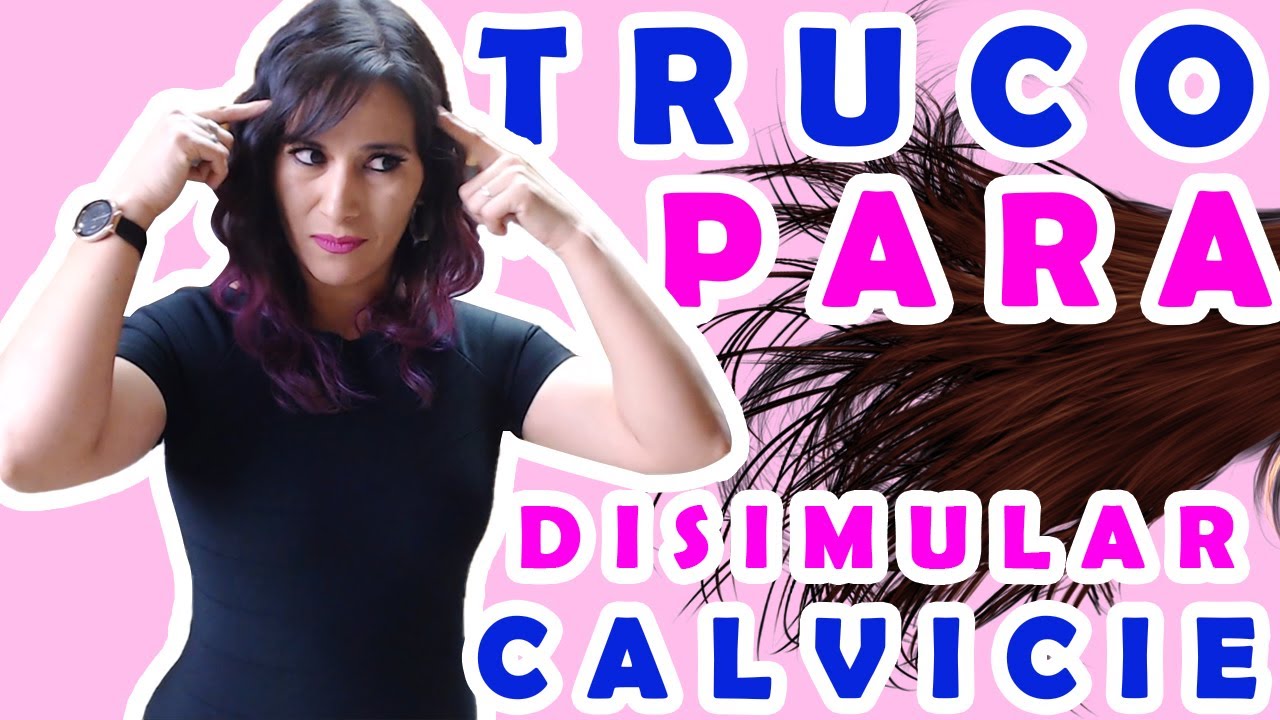 Como Disimular la Calvicie | El Spray Para Tapar Calvicie Que Yo Utilizo