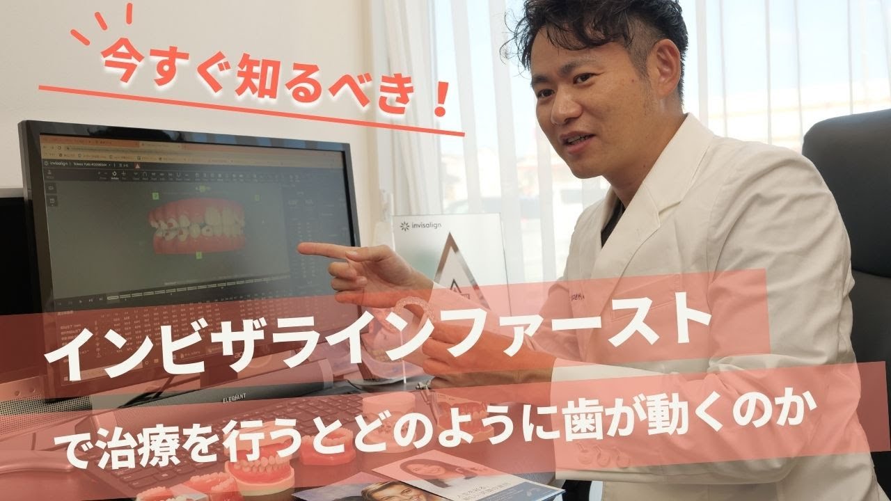 【インビザライン・ファースト】で矯正治療を行うとどのように歯が動くのか