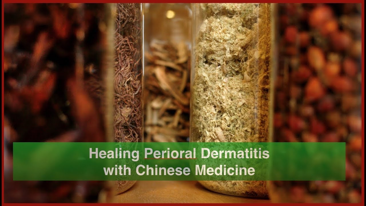 Natural Healing of Perioral Dermatitis with Chinese Medicine