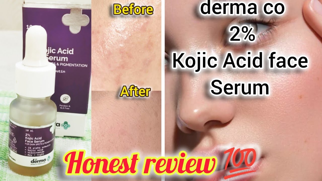 Derma Co Kojic Acid Serum Review in Tamil || Derma Co Kojic Acid Serum honest review 