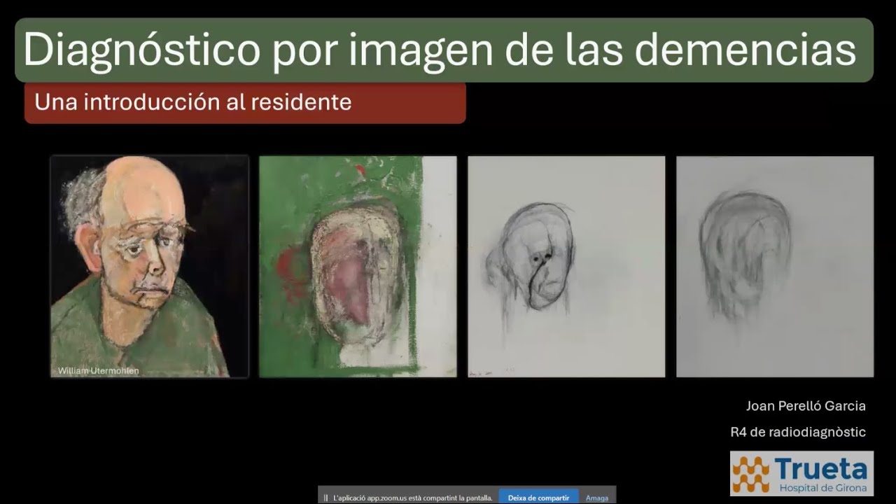 807. Introducción al estudio por imagen de la Demencia  Curso de Radiologia Esencial