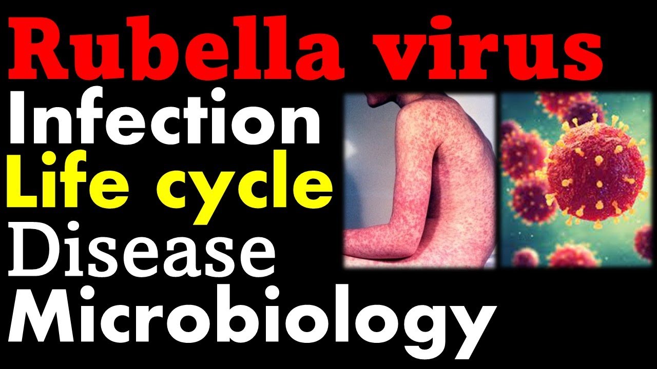 Rubella virus microbiology | infection, pathology, symptoms and replication cycle