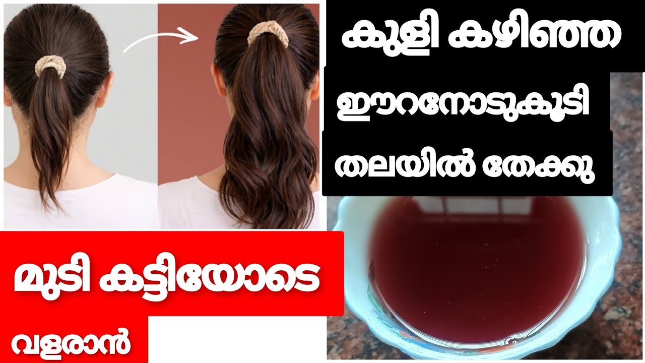 മുടി കട്ടിയോടെ വളരാൻ ഈ വെള്ളം മാത്രം മതി 