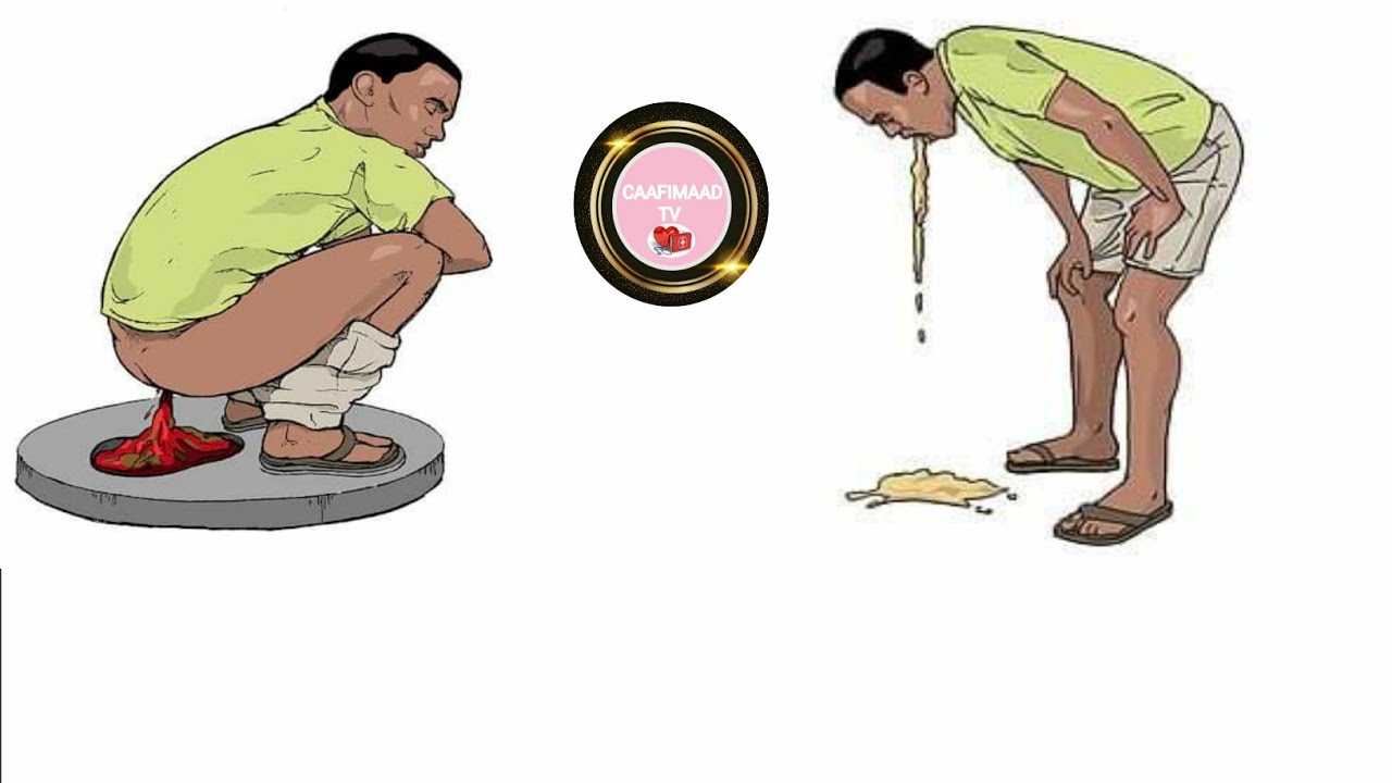 Sidee loola tacaala fuuqbaxa ama shubanka meel aanan dhaqtar kadhoweyn, ama adigo gurigada joogo ???