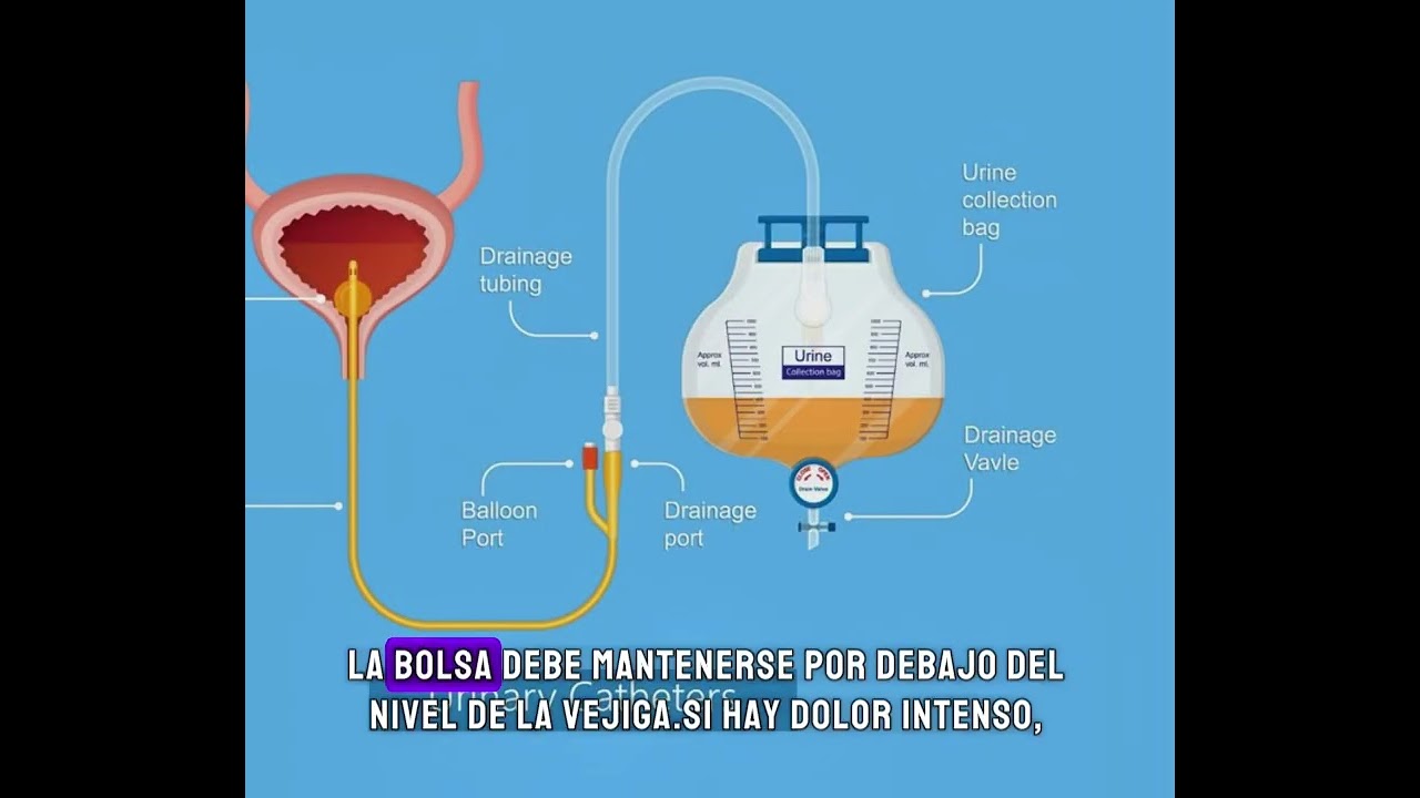 Sonda urinaria: cuidados clave, riesgos y cuándo consultar | Dr. Wade Lewin, Urólogo