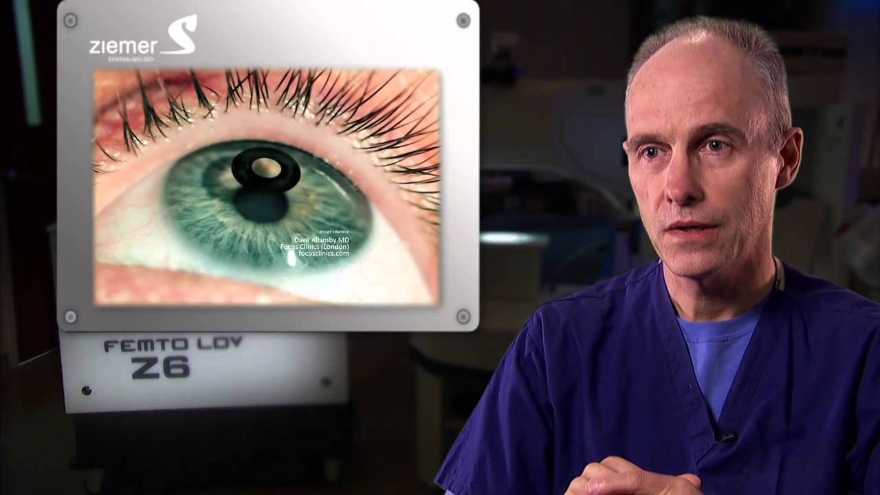 The new Z Lasik Z procedure with the FEMTO LDV Z Models