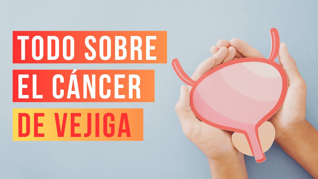 Cáncer de vejiga, todo sobre el quinto cáncer más común