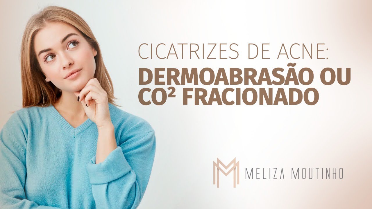 Cicatrizes de Acne: Dermoabrasão ou CO² fracionado ? Dra Meliza fala sobre tratamentos