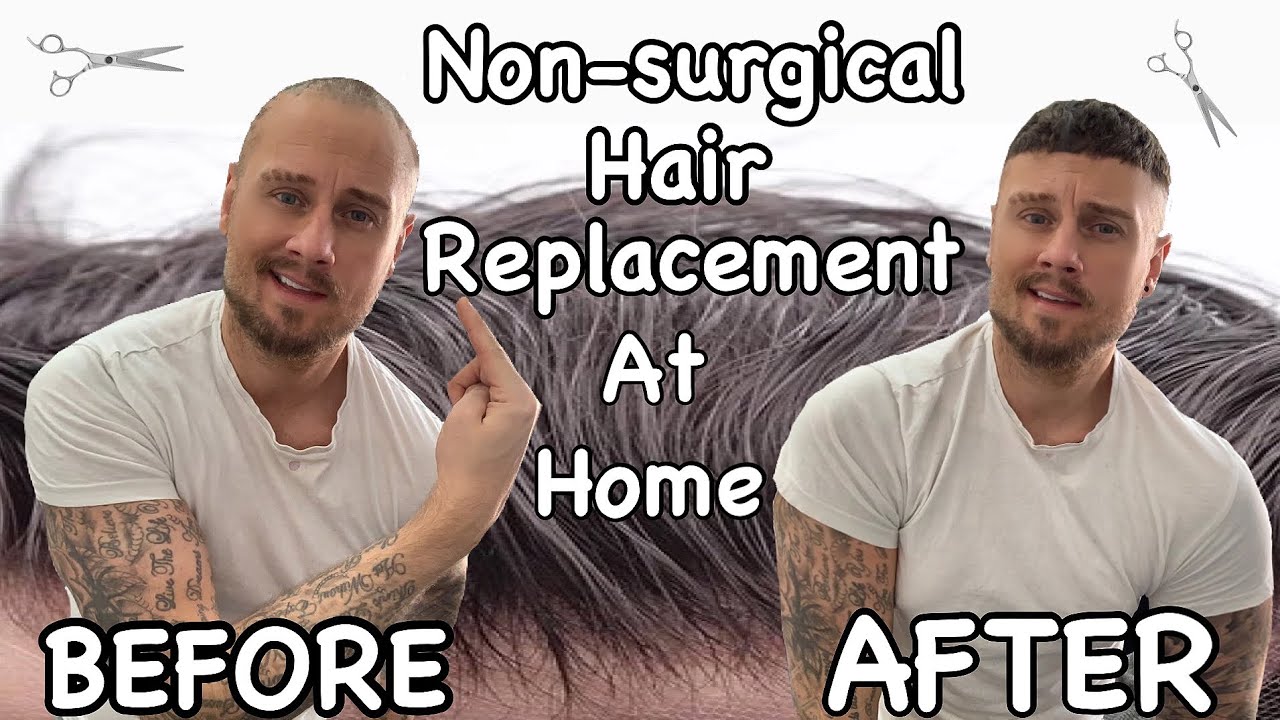 Hair Transformation | HAIR SYSTEM Before And After ✂️| At Home Non-Surgical Hair Replacement for Men
