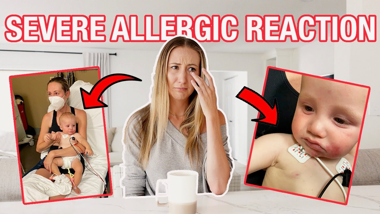 my baby has a severe peanut allergy- here's how I found out