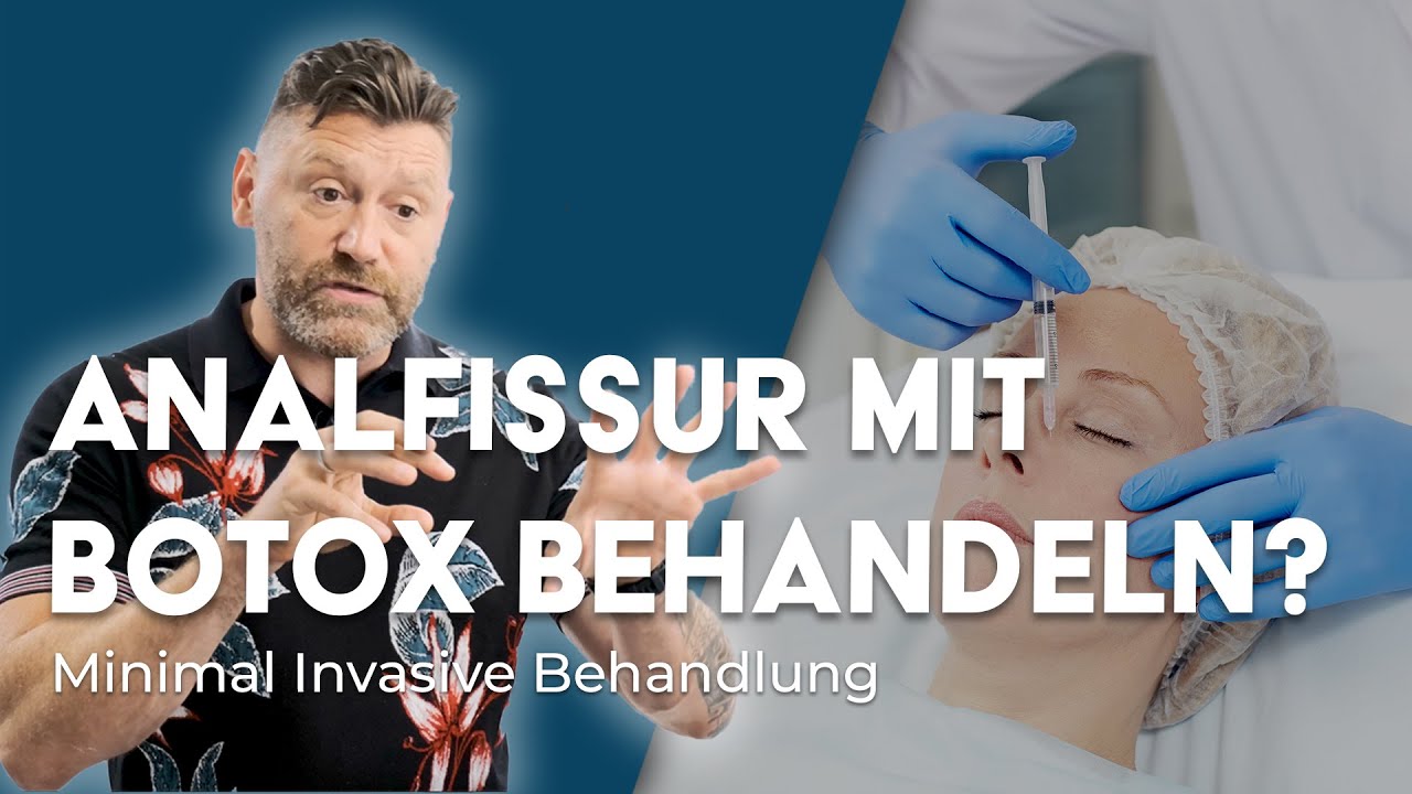 Analfissur mit Botox behandeln? So wird es gemacht | Dr. Eduard Karsten klärt auf