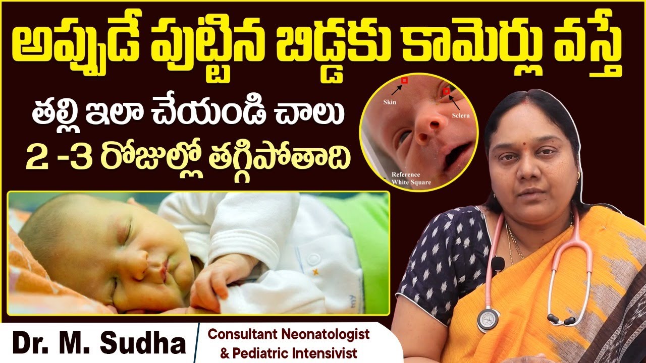 అప్పుడే పుట్టిన బిడ్డకు కామెర్లు | Tips On Treating Jaundice In Newborn Babies | Samraksha Hospitals