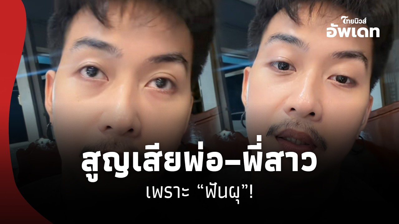 สะเทือนใจ! อินฟลูเอนเซอร์หนุ่มเล่าอุทาหรณ์สูญเสียพ่อ–พี่สาว เพราะ“ฟันผุ”!41- SS