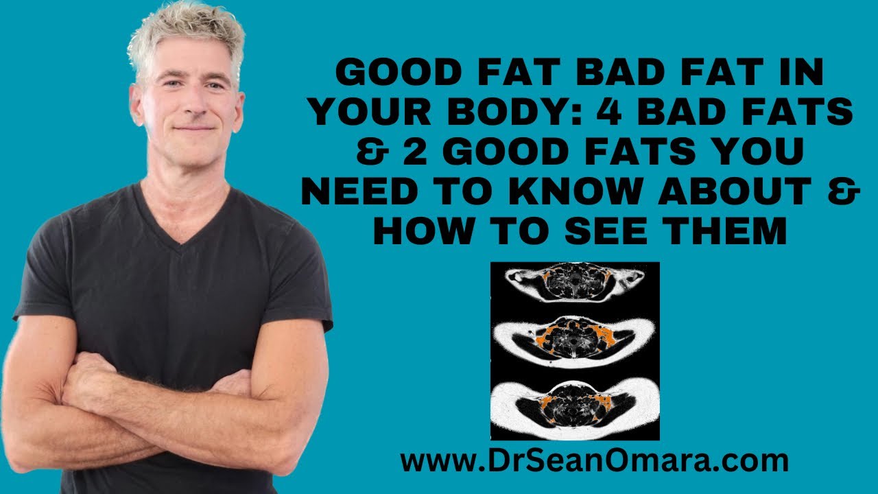 Not All Fat Inside You is The Same: 4 Bad Fat & 2 Good Fat. MRI Shows Them All!