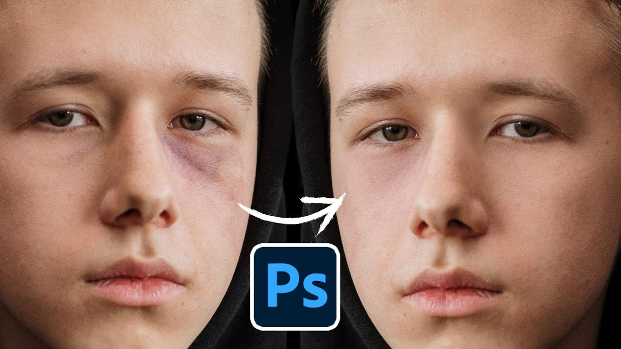 How to Fix Contusion Black Eye in Photoshop - Retouching Tutorial!