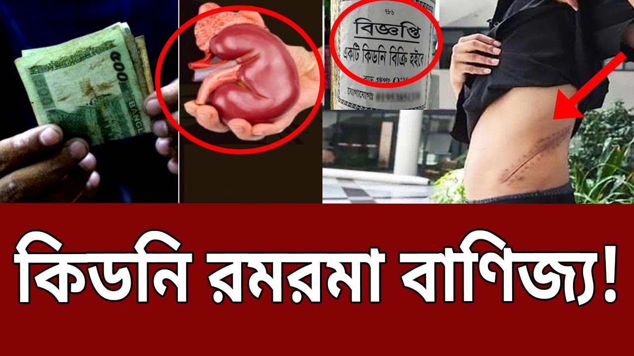 কিডনি রমরমা বাণিজ্য ! | Sell Kidney | Kideny Bazar | Mytv News