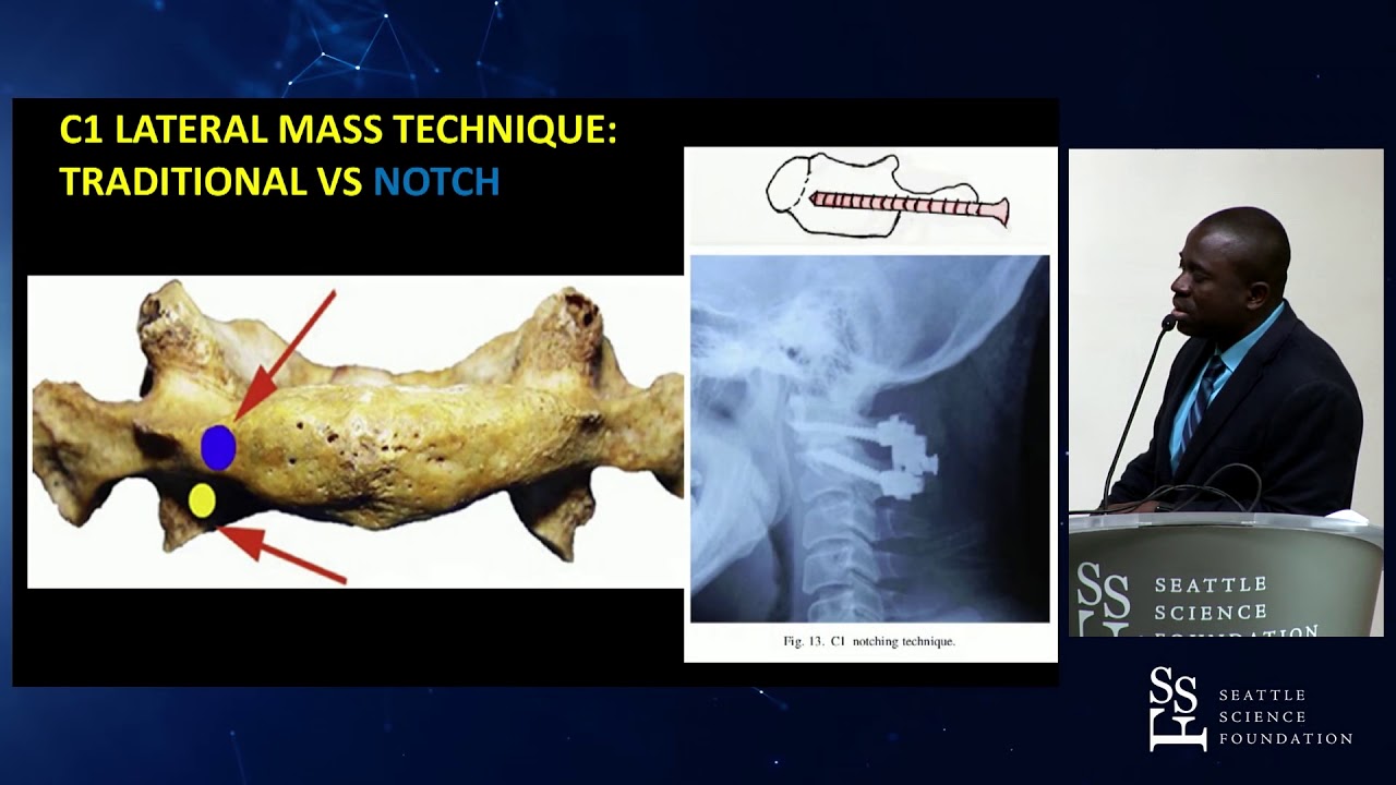 Cervical spine stabilization: anterior and posterior considerations - Isaac O. Karikari, MD, FAANS