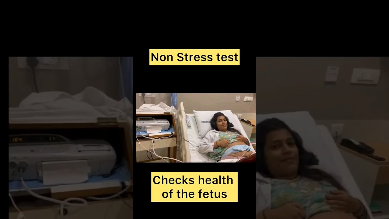 Non stress test Done at the end of pregnancy period to check the health of the unborn child.⚕️🏥💉