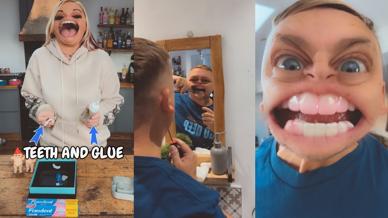 У него застряли зубы 😱