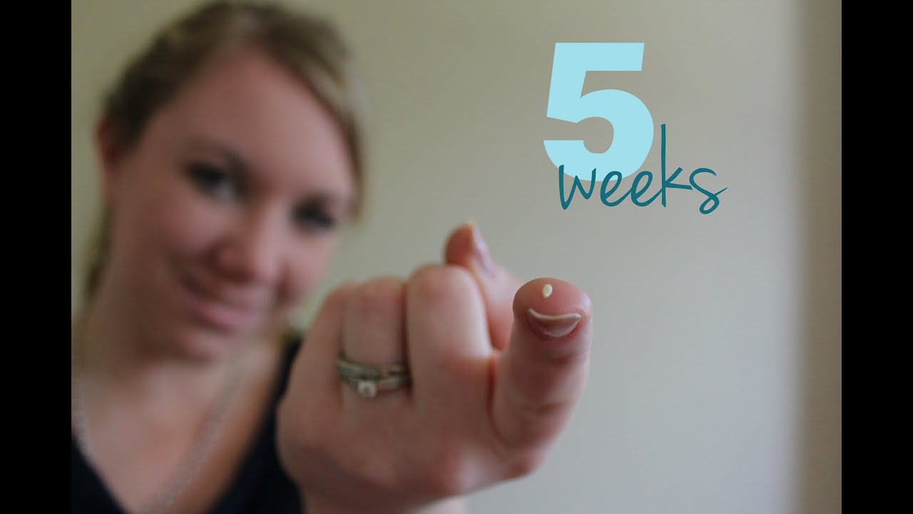 5 weeks Pregnant baby # 2  | IVF Pregnancy { Due date, BOOBS, Hayfever,}