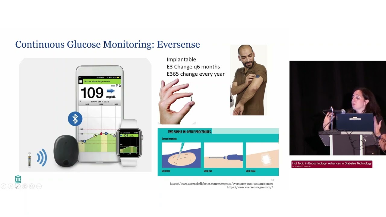 159  Hot Topic in Endocrinology   Advances in Diabetes Technology   Medstudylab.com