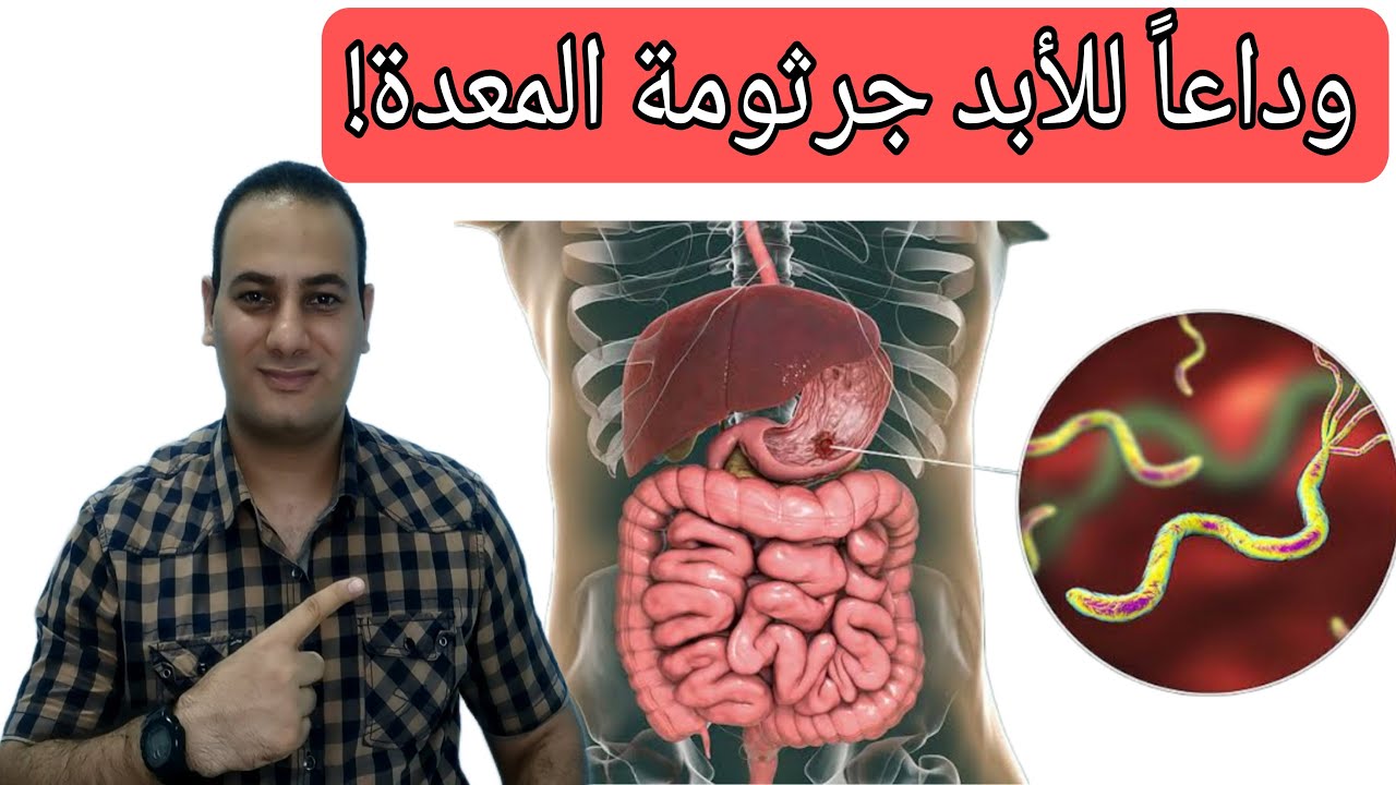 علاج جرثومة المعدة وتنظيف المعدة بكوب واحد فقط طبيعيا سيجعل معدتك جديدة😍