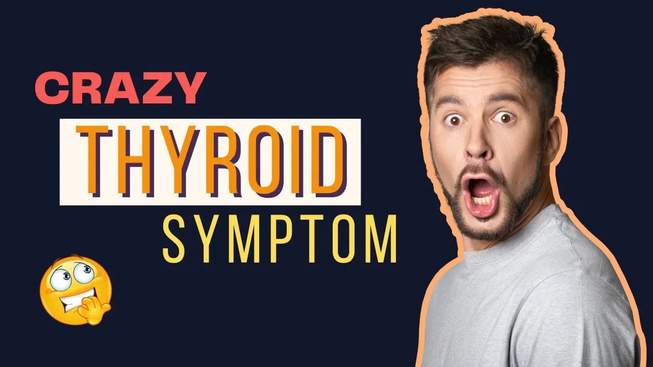 CRAZY Hives - Thyroid CONNECTION 🤯 (Urticaria + Dermatographia Too!)