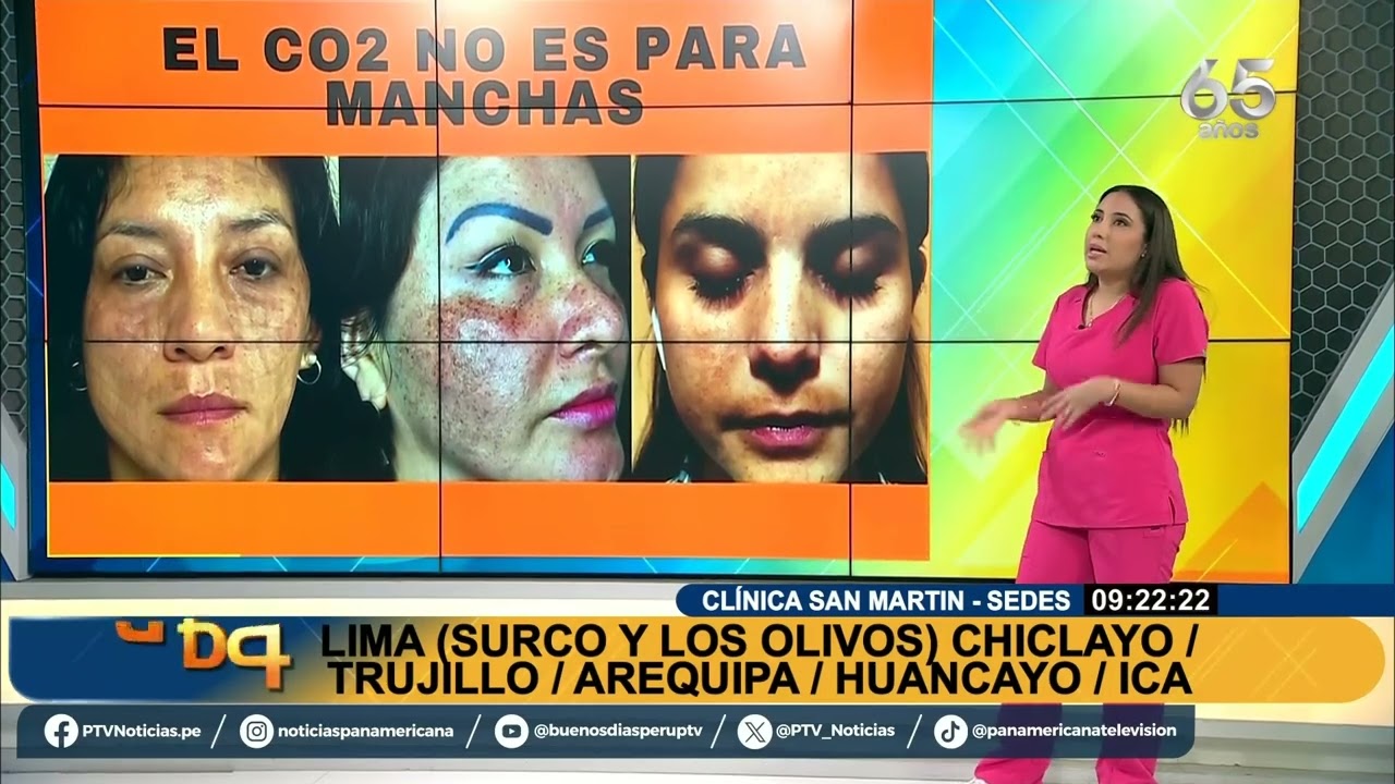 Conoce el verdadero uso del láser CO2