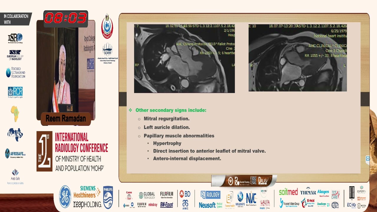 MRI in Hypertrophic Cardiomyopathy