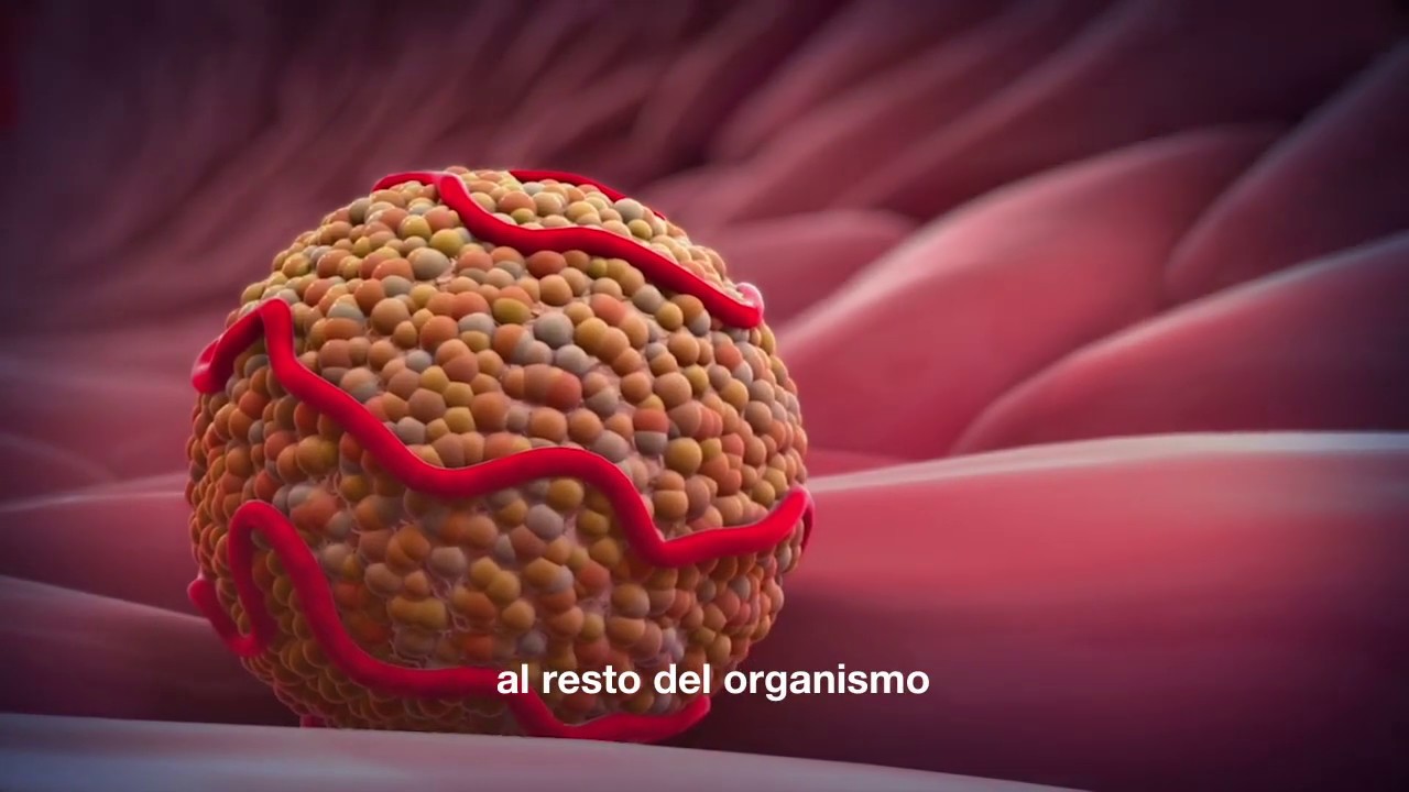 ¿Cómo se forma la placa de ateroma?