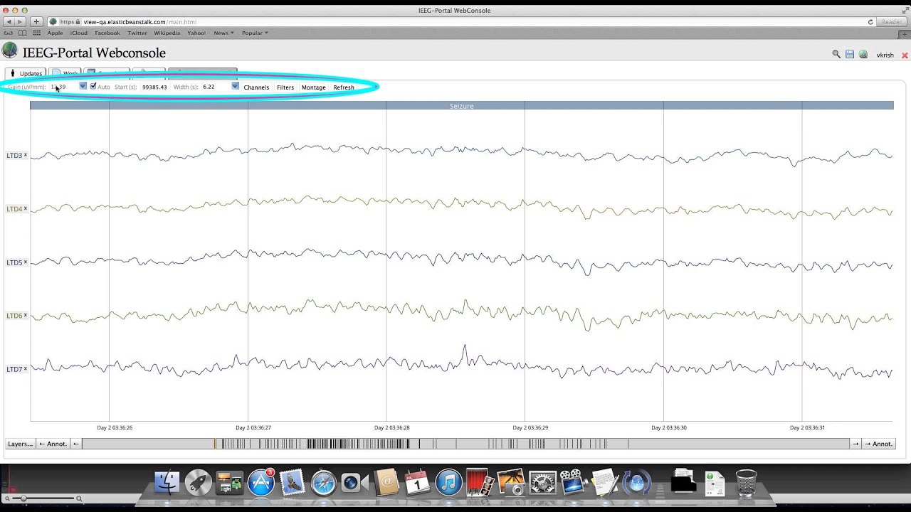 Video 2 - Navigating the IEEG-Portal