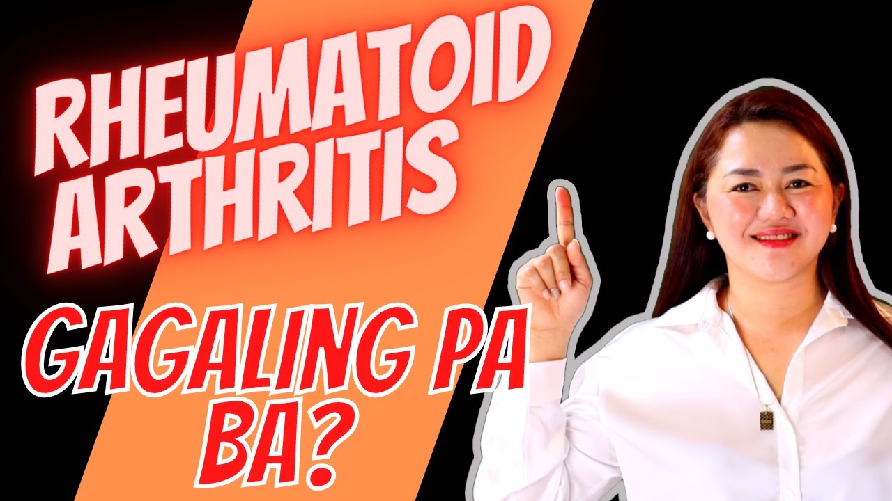 Ano ang mga Treatment Options Mo pag Ikaw ay may Rheumatoid Arthritis | Doc Cherry