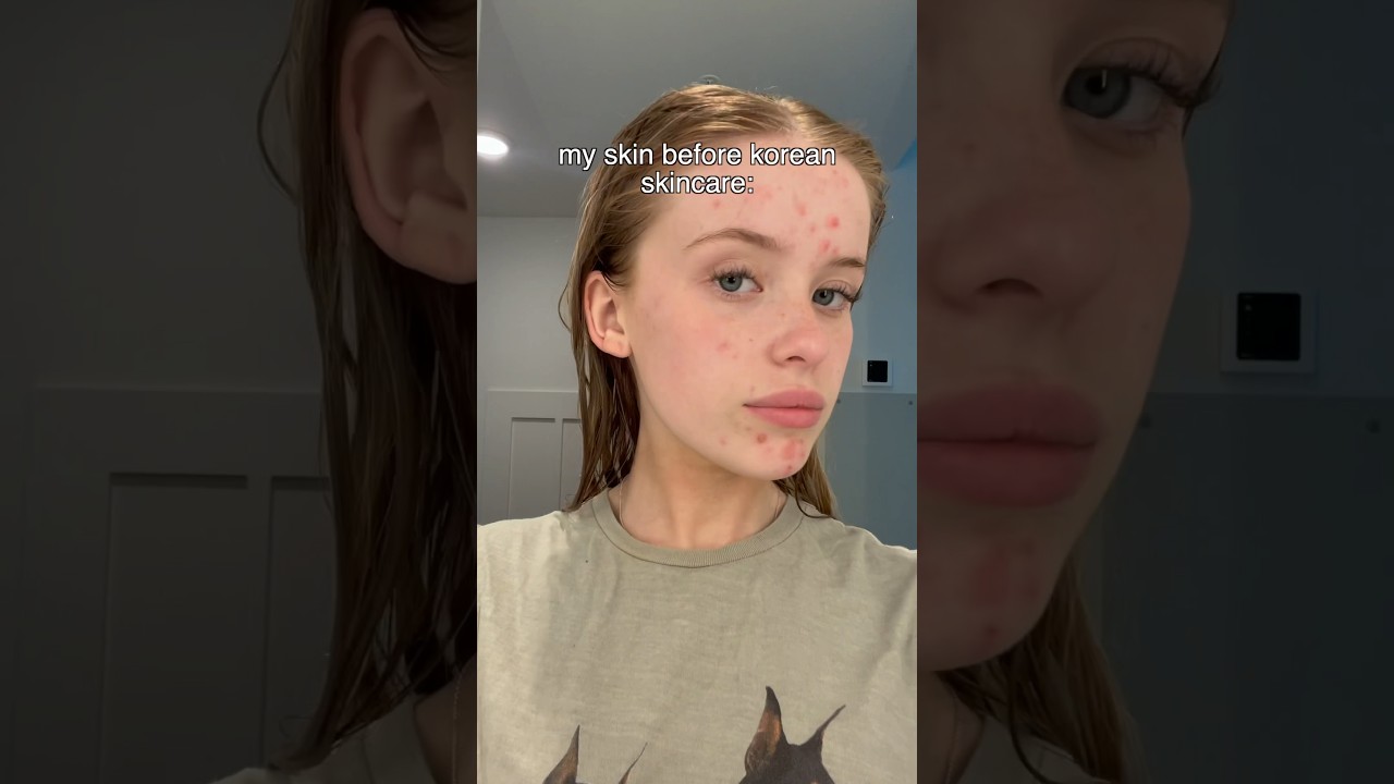 I tried a Korean skincare routine for 3 weeks heres the results so far✨see description 👇🏼😘🫶🏼