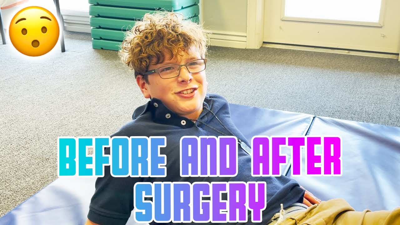 BEFORE AND AFTER SURGERY PROGRESS FOR 10 YEAR OLD BOY | 11 MONTHS AFTER SURGERY | INCREDIBLE RESULTS