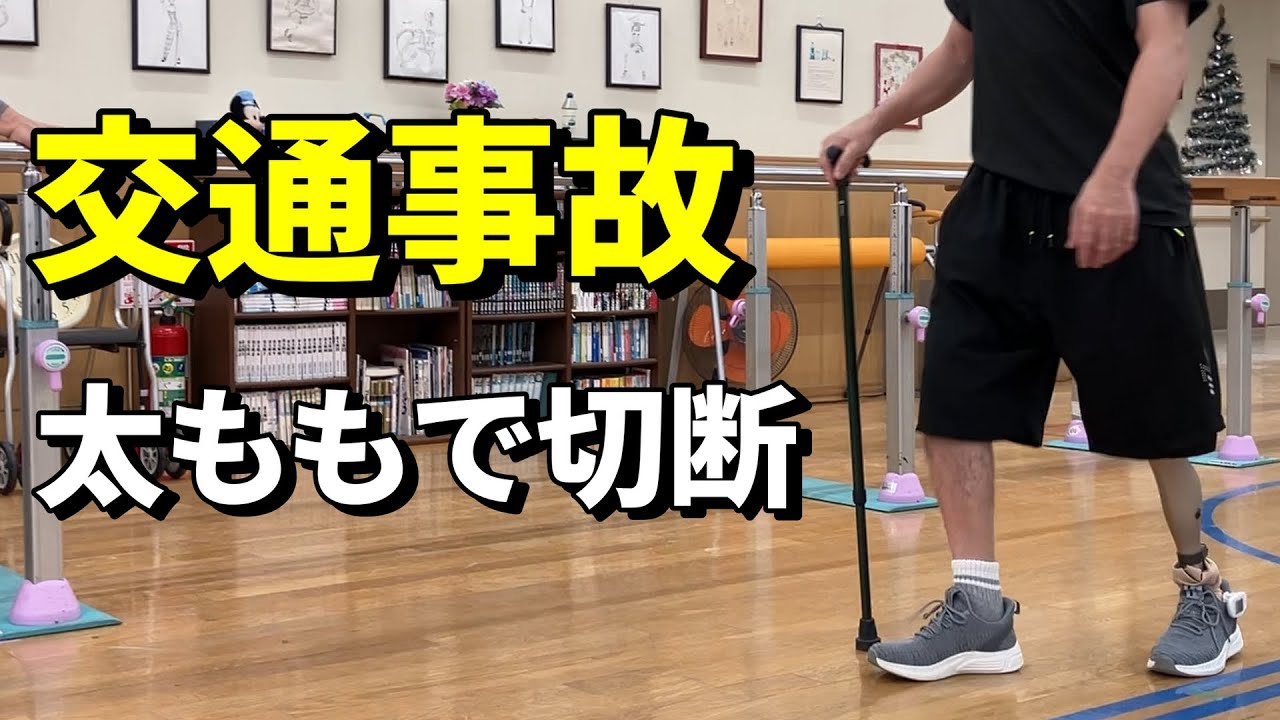 【大腿切断】バイク事故で太ももから脚を切断した男性【義足で歩く⑧】