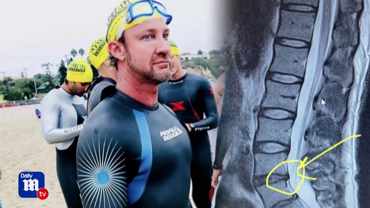 Triathlete's Career-saving Spine Surgery | The Spine Pro