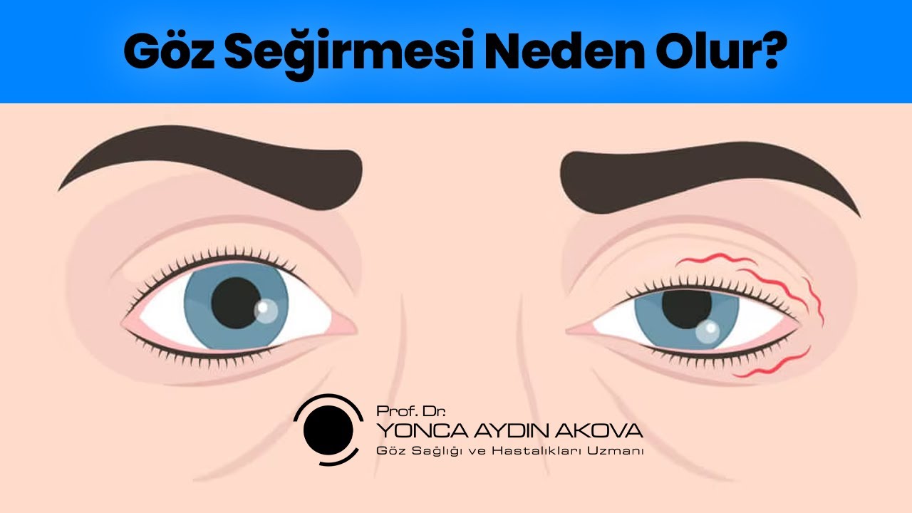 Göz Seğirmesi Neden Olur? - Prof. Dr. Yonca Aydın Akova