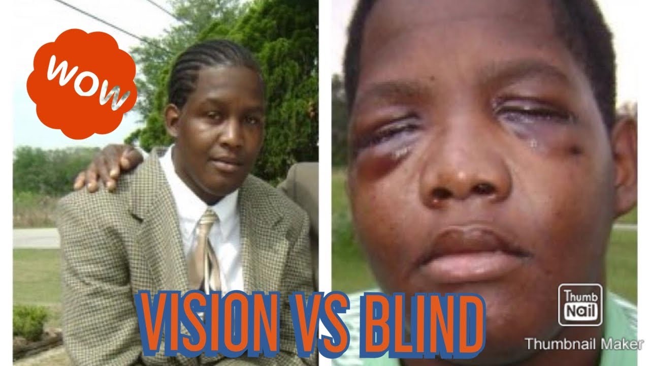 VLOGMAS (STORY TIME) HOW I became blind