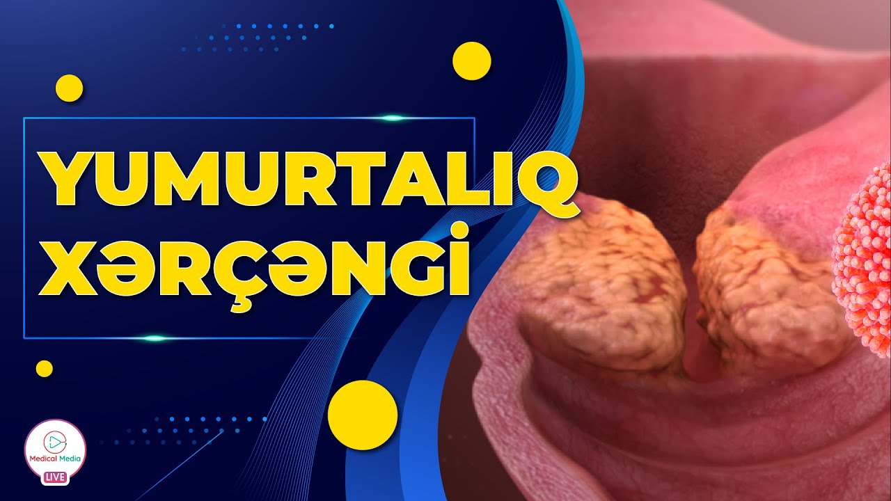 YUMURTALIQ XƏRÇƏNGİ / YUMURTALIQ XƏRÇƏNGİNİN ƏLAMƏTLƏRİ NƏLƏRDİR?