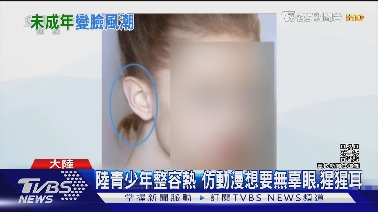 陸青少年整容熱 仿動漫想要無辜眼.猩猩耳｜TVBS新聞