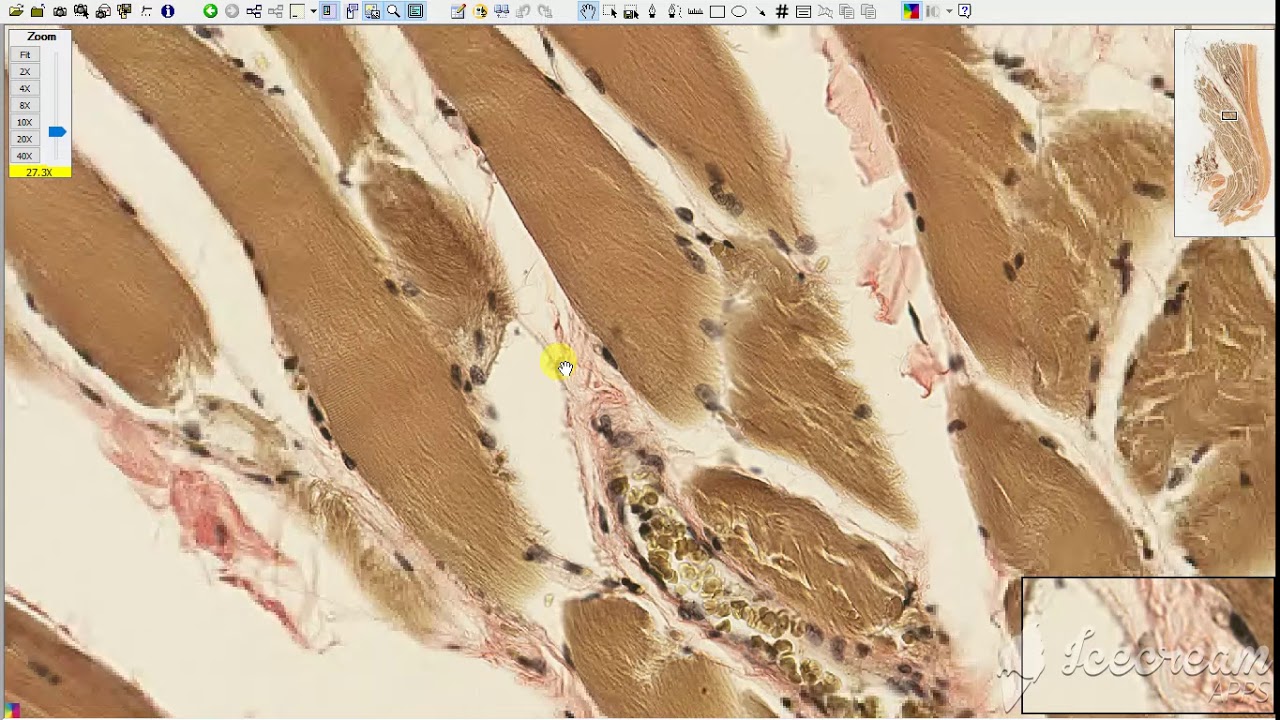 Elastic Connective tissue