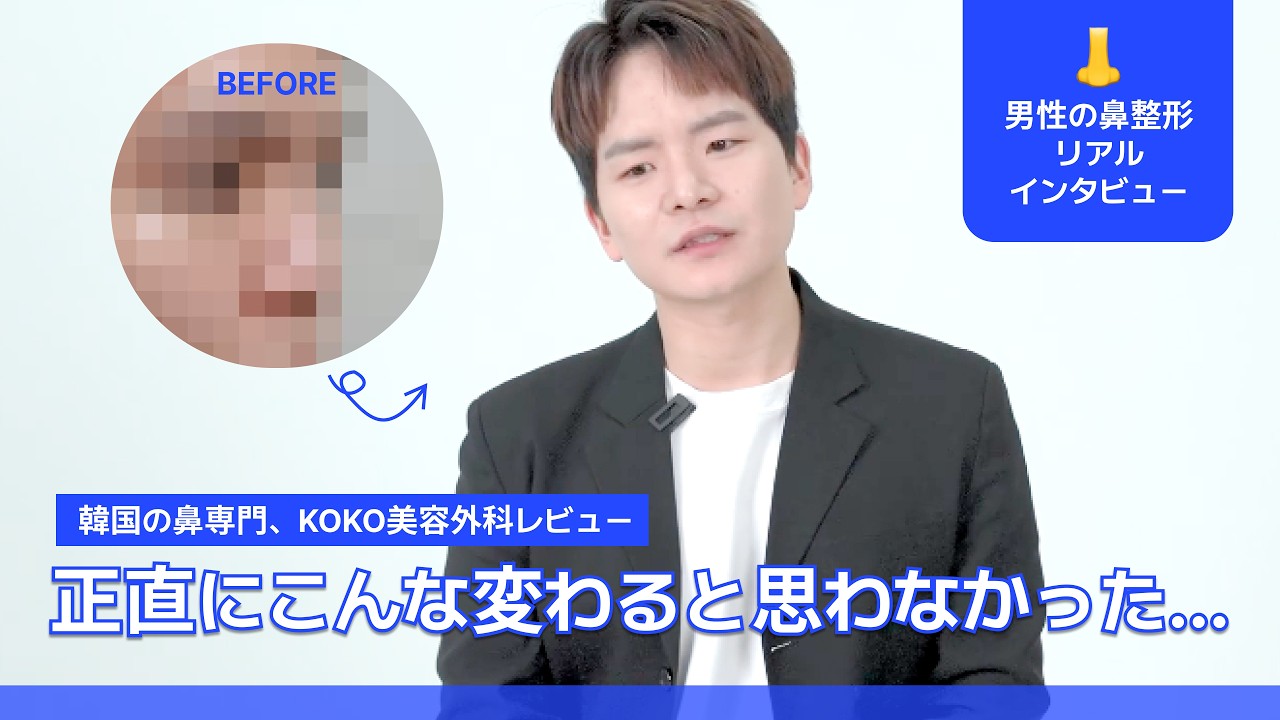 低い鼻、アップノーズで悩んでいましたが、鼻の手術後に人生が変わりました！｜男性の鼻整形のビフォーアフターまでしっかりインタビュー！ #韓国整形 #韓国鼻整形