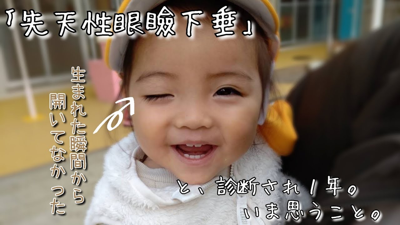 【 先天性眼瞼下垂と診断から１年。】