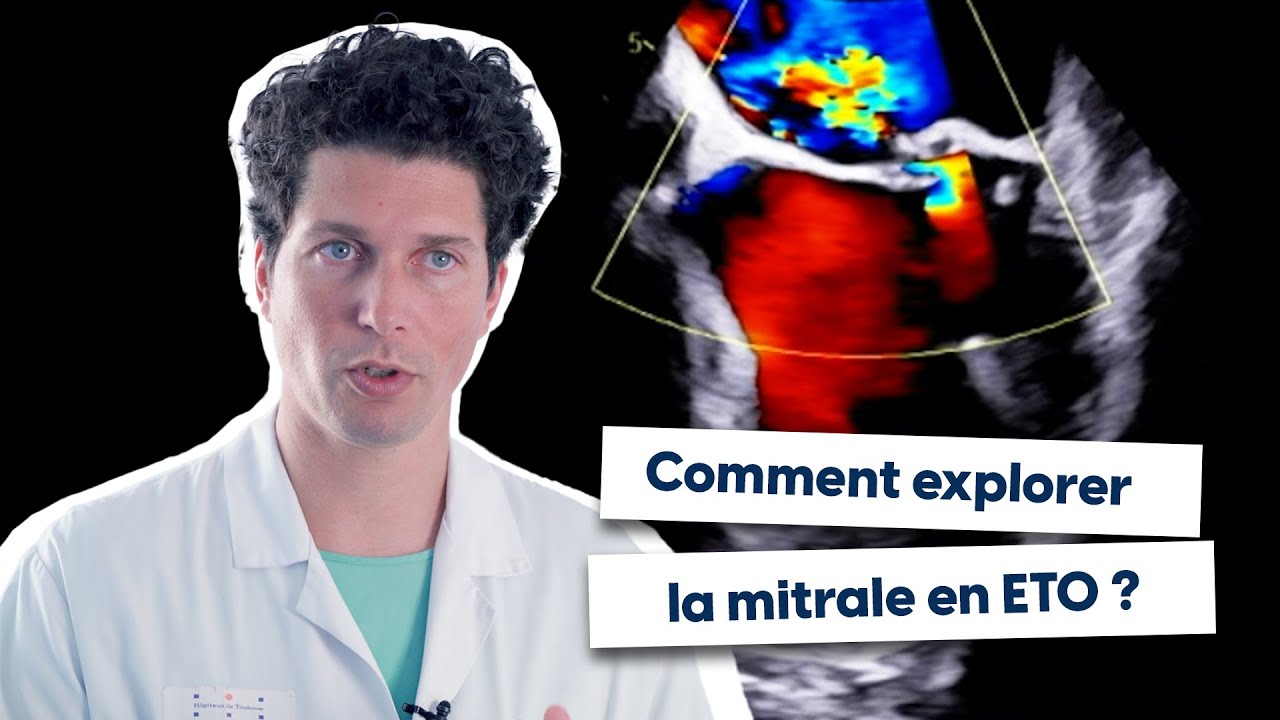 Comment explorer la mitrale en ETO ?