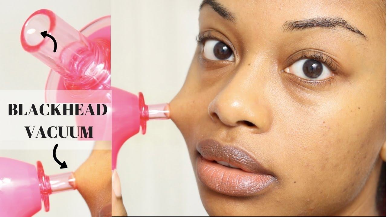 BLACKHEAD PORE VACUUM SUCTION! EWWW | journeytowaistlength