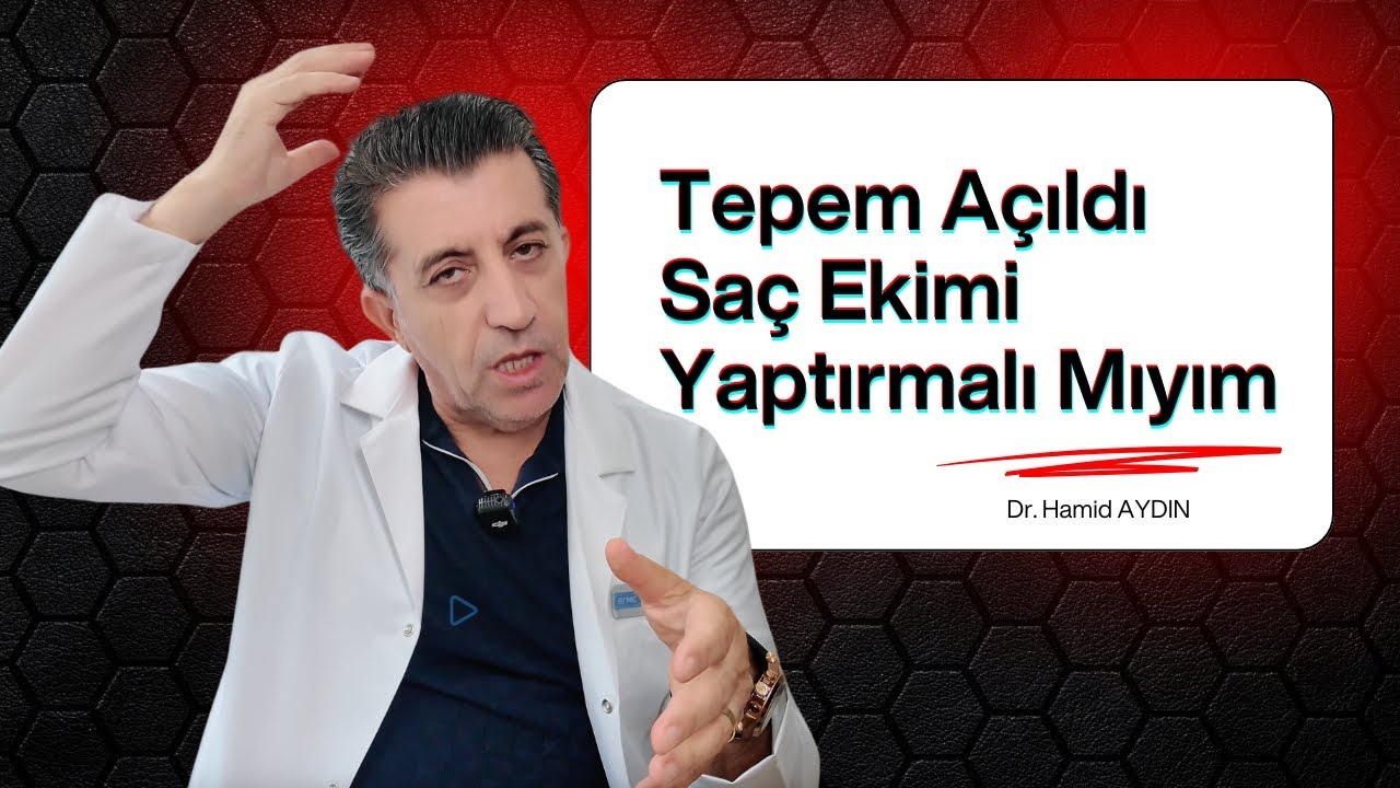 Tepem A&ccedil;ıldı Sa&ccedil; Ekimi Yaptırmalı Mıyım? Dr. Hamid AYDIN #sa&ccedil;ekimi