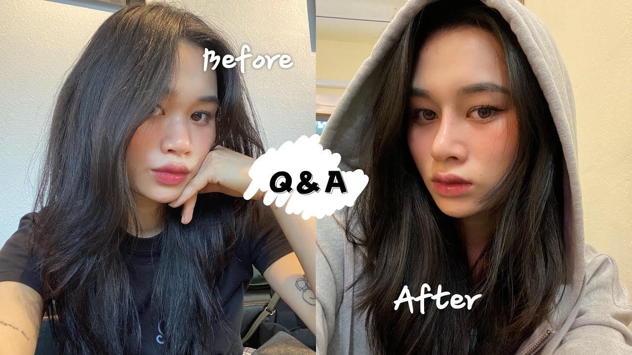Q&A | Giải đáp mọi thắc mắc về phẫu thuật mũi tại Hàn Quốc